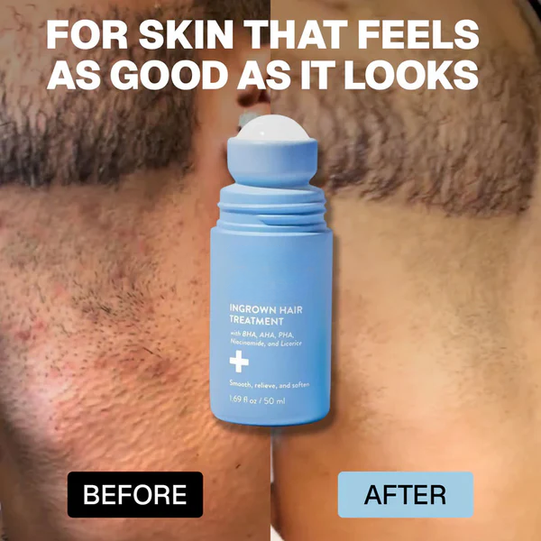 roshang: Smoothing Solution For Ingrown Hairs