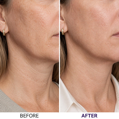 Collagen & PDRN Hydrogel Neck Patch（4Ea）