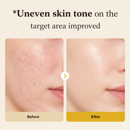 Kojic Acid Turmeric Night Wrapping Mask
