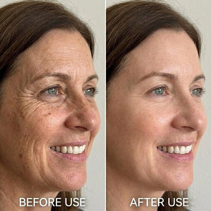 roshang Face Serum