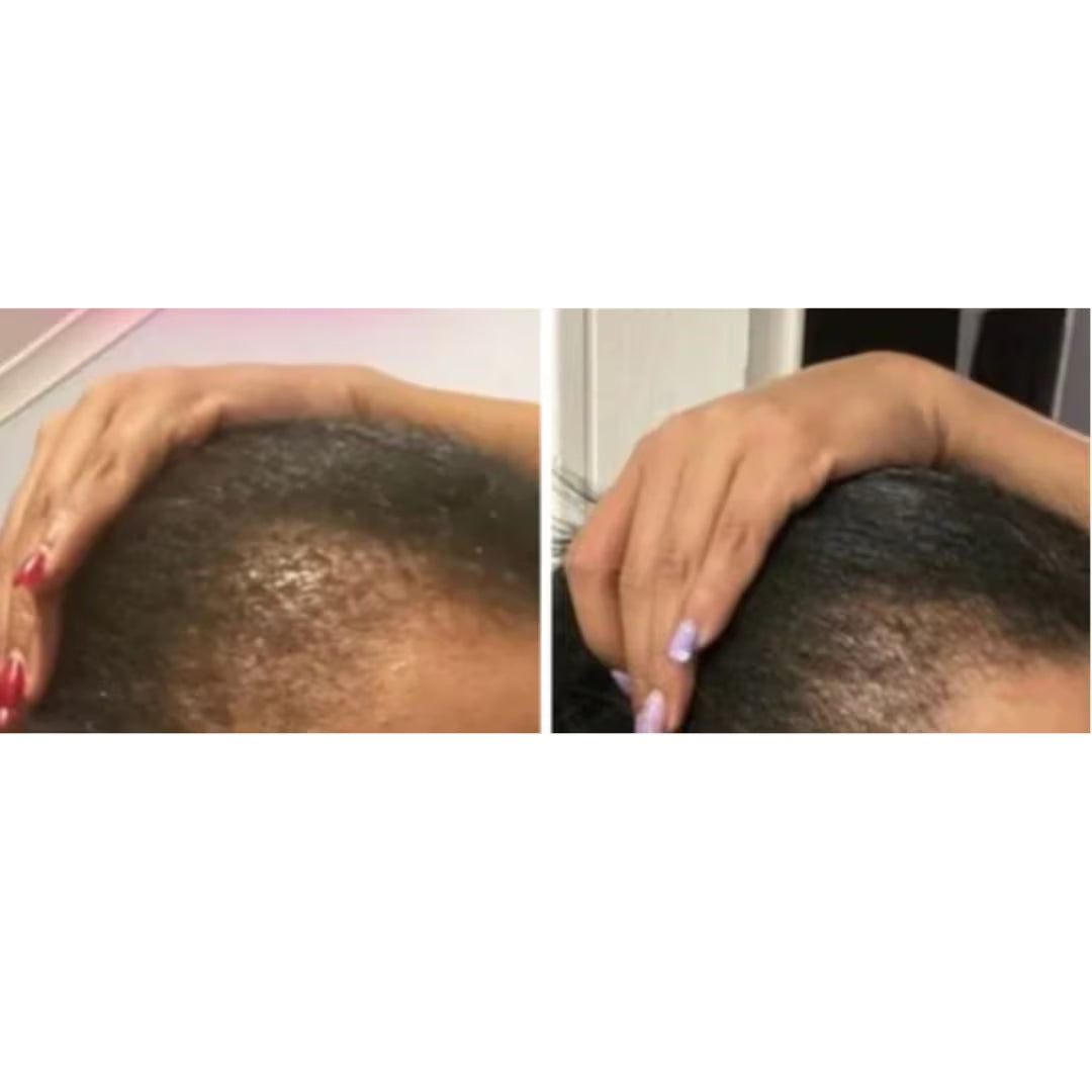 before-and-after.avif