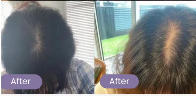 before_after.avif