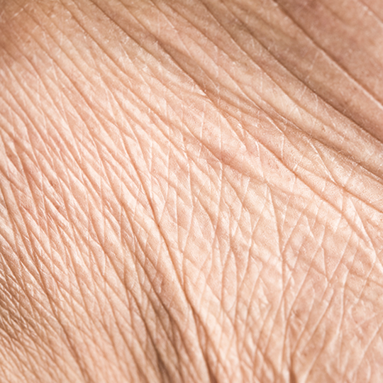 skin-wrinkles_1.png